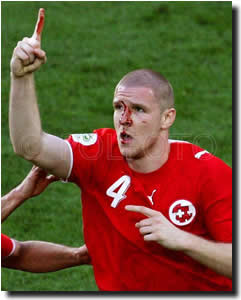 Philippe Senderos bleeds for the cause...